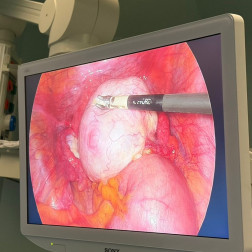 658968166_18406764166181150_4052576049151052919_n